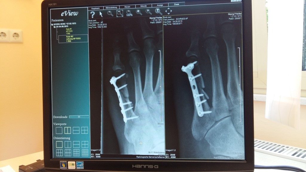 X Ray Image